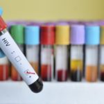 HIV, AIDS
