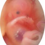 (v delu) V Franciji abortus uradno dopuščena praksa že od leta 1975 – ga bodo sedaj ukinili? 3