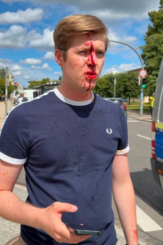 Levičarski ekstremisti napadli člana AfD – policija naj bi gledala stran