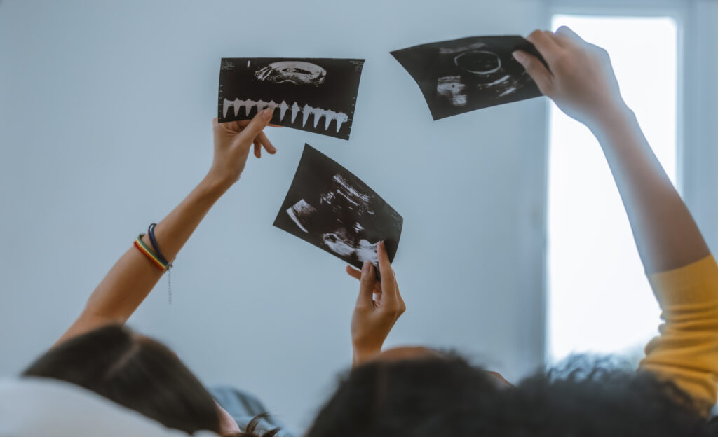 Zavrnila je abortus, ko so ji rekli, da otroka nimata možnosti – in dokazala, da so se zmotili